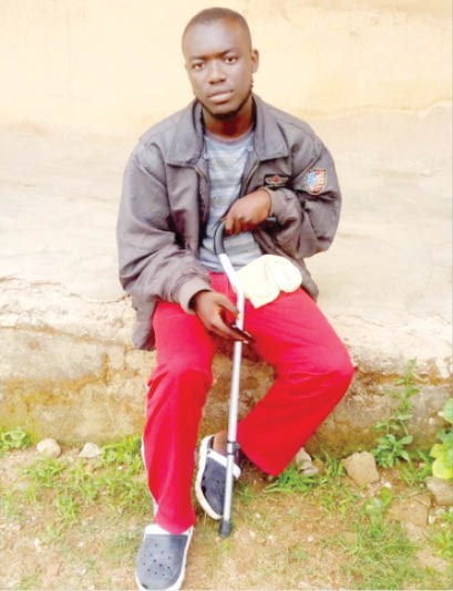 Gyang Emmanuel has had to rely on a walking stick and is prevented from working. Photo: Daily Trust