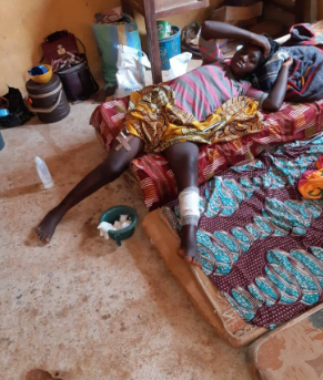Patience Peter, initially thought dead after she was shot thrice by suspected Fulani gunmen during the August attack on Kurmin Masara, now receiving treatment at IDPs’ camp, Zonkwa, Zangon Kataf LGA. [Credit: Taiwo Hassan Adebayo/Premium Times]